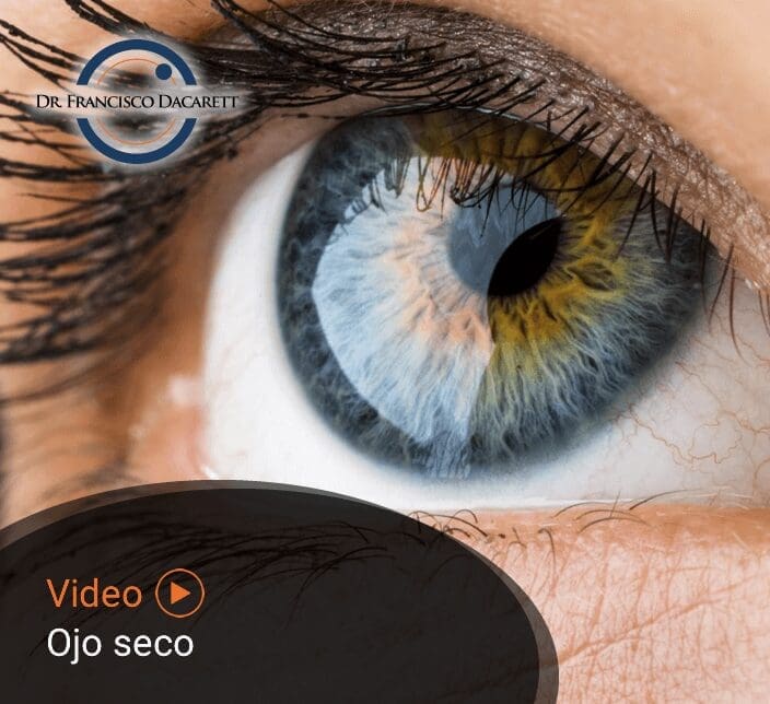 Conoce más sobre el Ojo seco por el oftalmólogo y retinólogo Dr. Francisco Dacarett