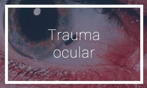 Trauma ocular - Dr. Francisco Dacarett